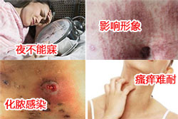 皮肤瘙痒有哪些危害？